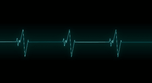 Login VSI Blog - Login VSI - Is Heart Monitoring a Must-Have for Digital Transformation? - Image 1 - Heart Monitor